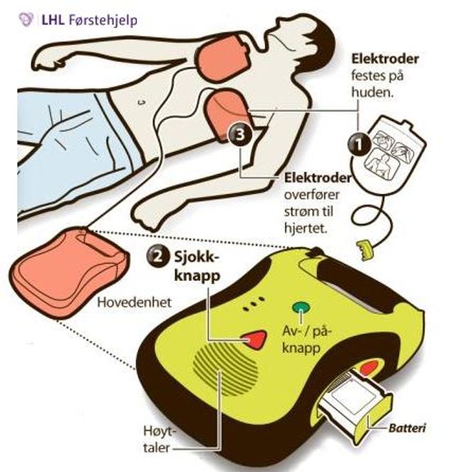 Hovedbilde Lifeline AED Hjertestarterpakke, 5 års batteri